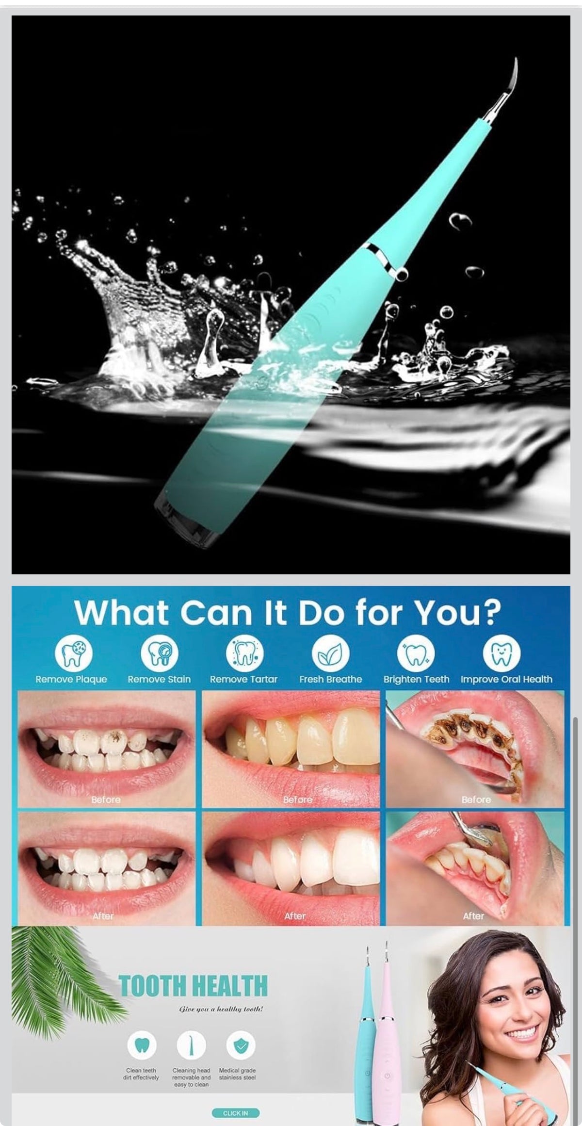 Dental Calculus Remover
