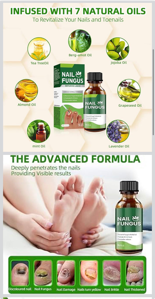Nail Fungus Repairing Liquid
